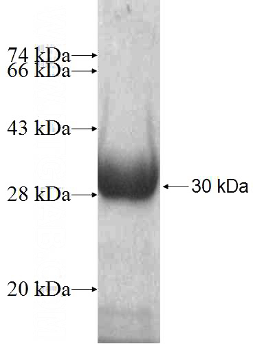 Recombinant Human ATP4B SDS-PAGE
