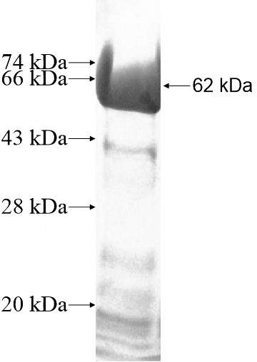 Recombinant Human CPOX SDS-PAGE