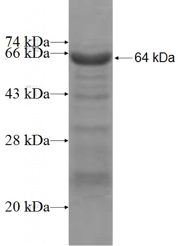 Recombinant Human ZNF410 SDS-PAGE