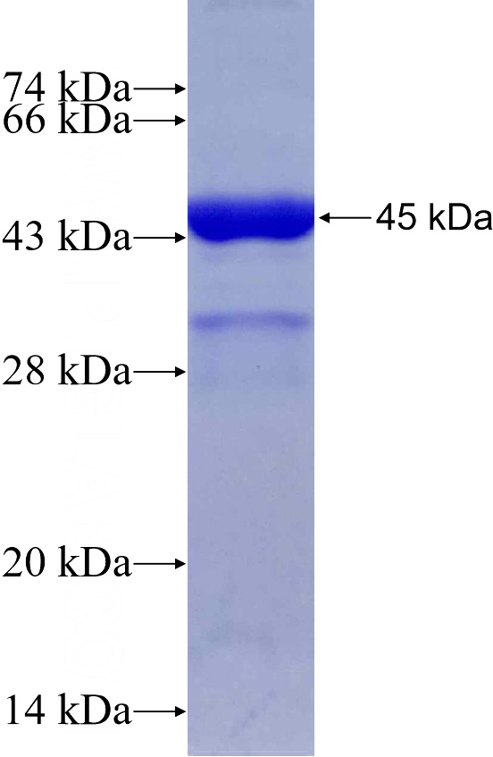 Recombinant Human DSTN SDS-PAGE