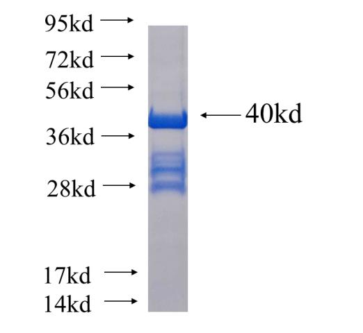 Recombinant human MARK4 SDS-PAGE