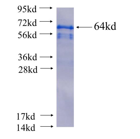 Recombinant human QKI(Full length) SDS-PAGE