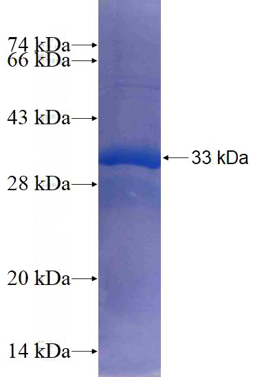 Recombinant Human CDS2 SDS-PAGE
