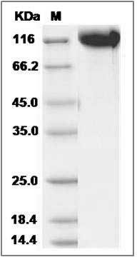 Rat E-Selectin / CD62e / SELE Protein (Fc Tag) SDS-PAGE