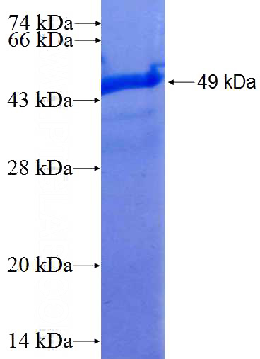 Recombinant Human YAF2 SDS-PAGE