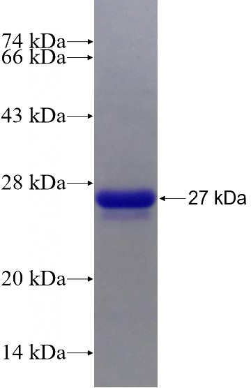 Recombinant Human C1orf93 SDS-PAGE
