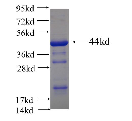 Recombinant human HECTD2 SDS-PAGE