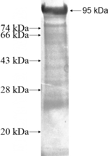 Recombinant Human HEMGN SDS-PAGE