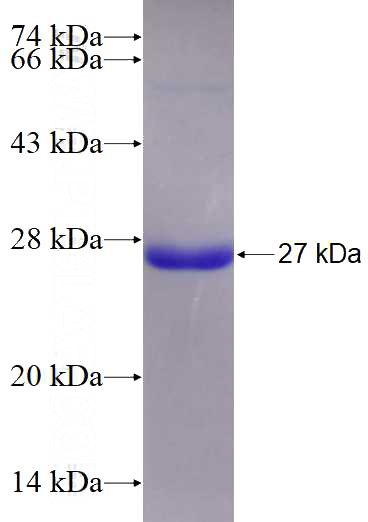 Recombinant Human RAB3D SDS-PAGE