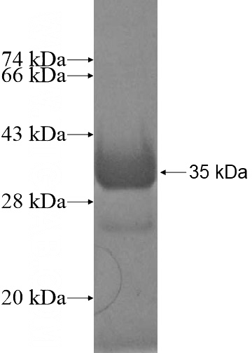 Recombinant Human DOHH SDS-PAGE