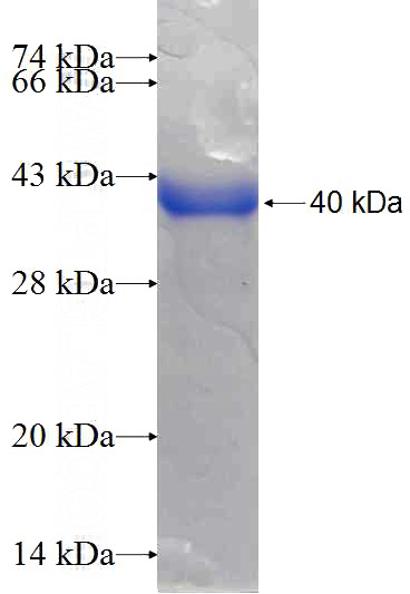 Recombinant Human HIP14; ZDHHC17 SDS-PAGE