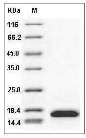 Human Cystatin SA / CST2 Protein (His Tag) SDS-PAGE