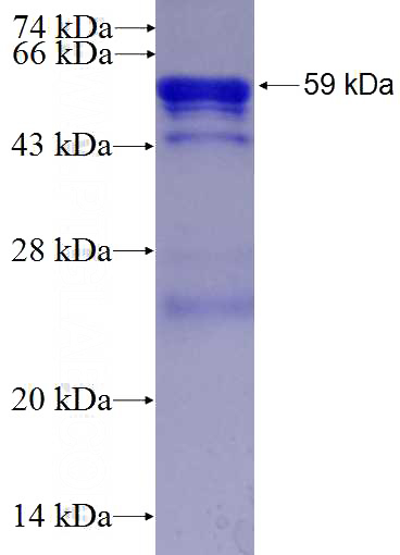 Recombinant Human LAMR1,RPSA SDS-PAGE