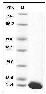 Mouse S100A5 Protein (His Tag) SDS-PAGE