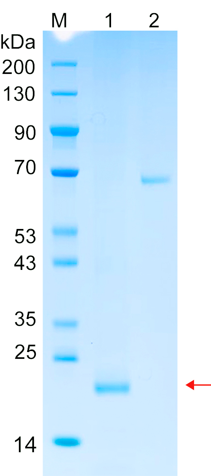 Recombinant LMO7 protein (His tag) SDS-PAGE