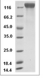 Human VEGFR2/KDR/Flk-1/CD309 Protein 15910