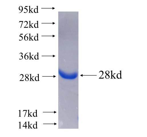 Recombinant human LZTS1 SDS-PAGE