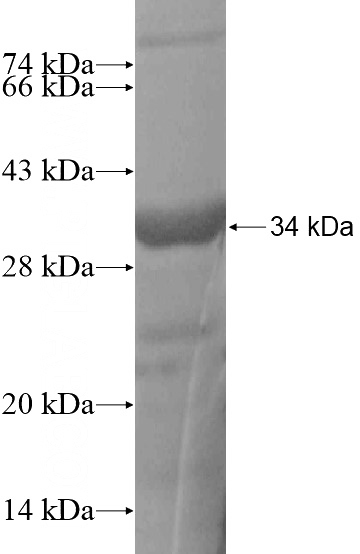 Recombinant Human CLPTM1L SDS-PAGE