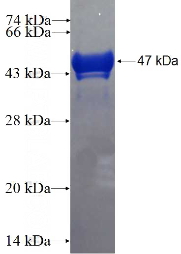 Recombinant Human ARL2 SDS-PAGE