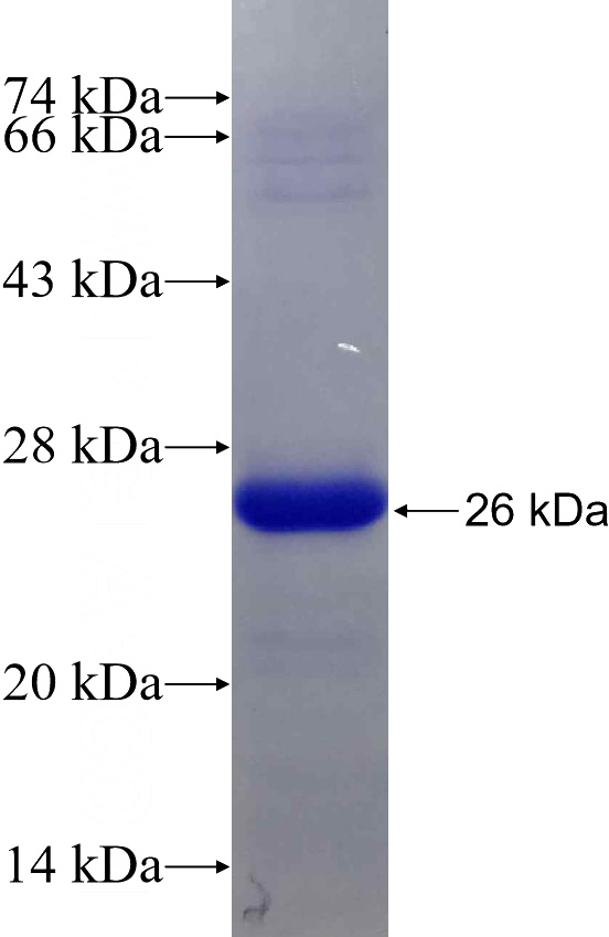 Recombinant Human PRKACA SDS-PAGE