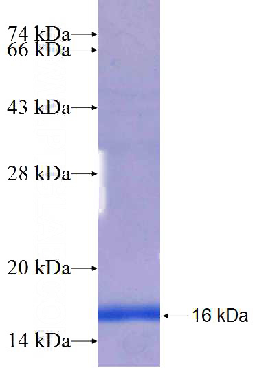 Recombinant Human BIRC3 SDS-PAGE