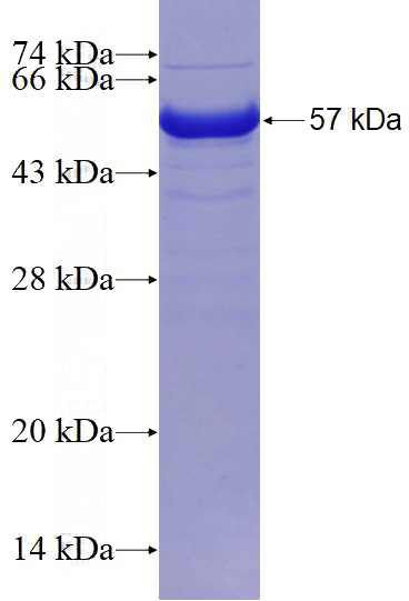 Recombinant Human AGGF1 SDS-PAGE