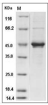 Rat Cripto / TDGF1 Protein (Fc Tag) SDS-PAGE