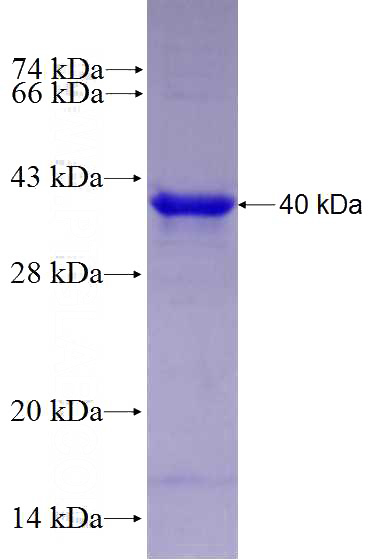 Recombinant Human PPARD SDS-PAGE