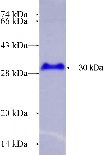 Recombinant Human ZNF143 SDS-PAGE