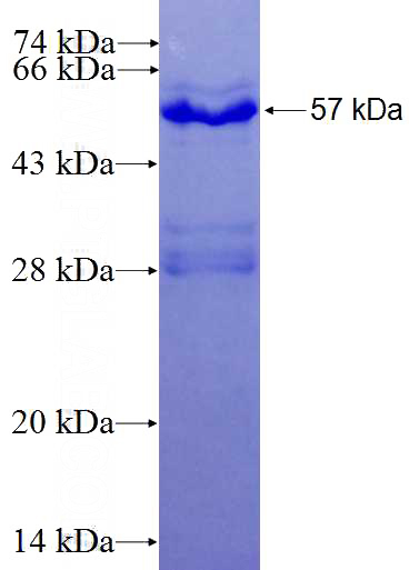 Recombinant Human SIAH1 SDS-PAGE