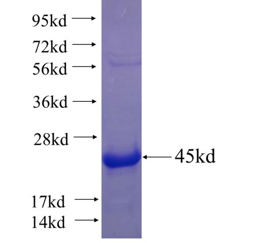 Recombinant human CXCL16 SDS-PAGE