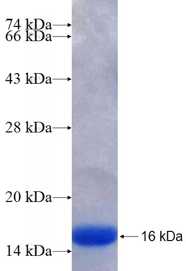 Recombinant Human GLIPR2 SDS-PAGE