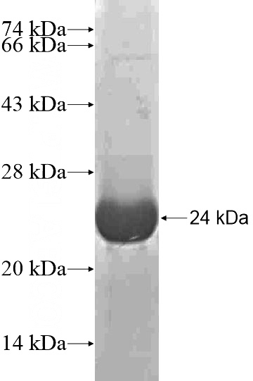 Recombinant Human SLC26A4 SDS-PAGE