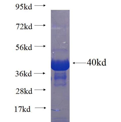 Recombinant human RNF144A SDS-PAGE
