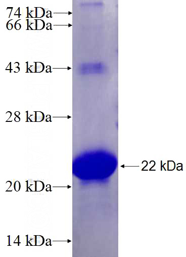 Recombinant Human RNF182 SDS-PAGE