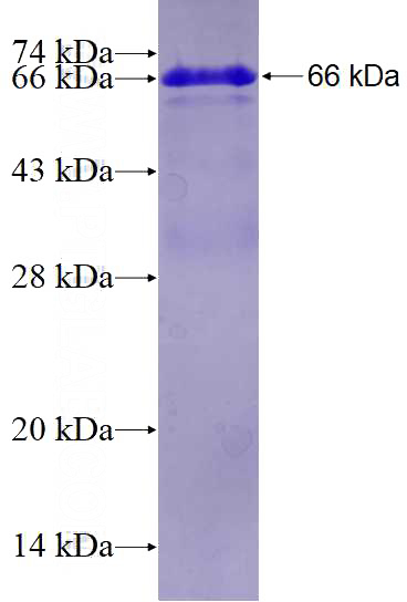 Recombinant Human CDH23 SDS-PAGE