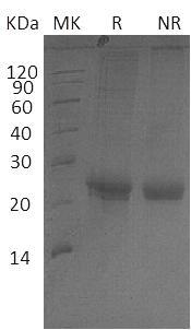 Human NECTIN1/HVEC/PRR1/PVRL1 (His tag) recombinant protein