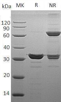 Human ETFB/FP585 (His tag) recombinant protein