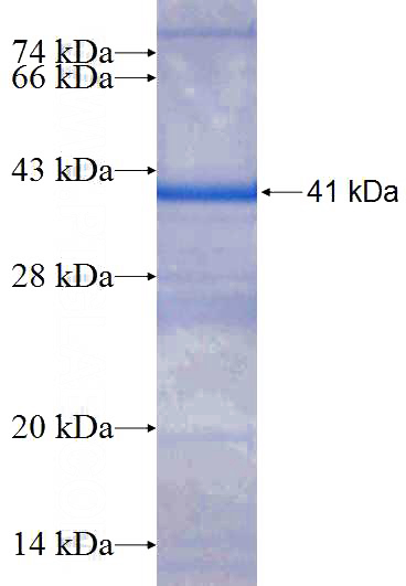 Recombinant Human PI4K2A SDS-PAGE