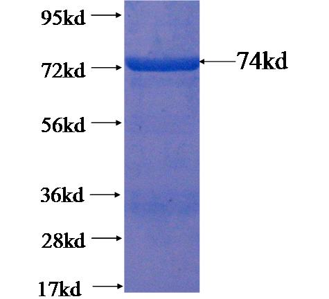 Recombinant human TBCEL SDS-PAGE