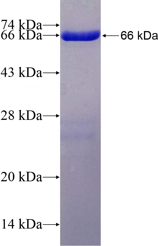 Recombinant Human MAPK6 SDS-PAGE