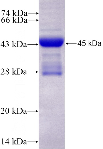 Recombinant Human MYL7 SDS-PAGE