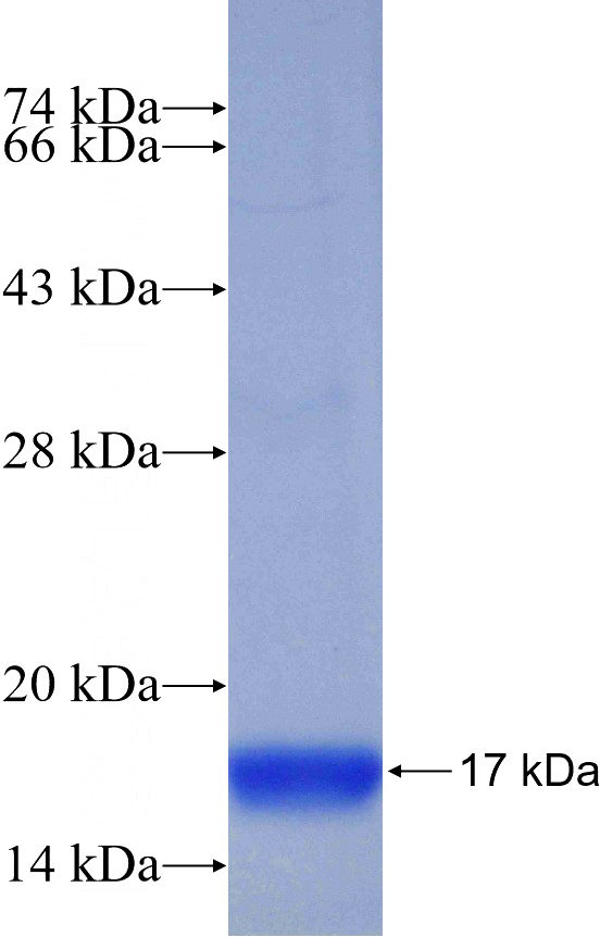 Recombinant Human Integrin beta-5 SDS-PAGE