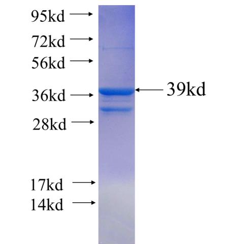 Recombinant human FOXP1 SDS-PAGE