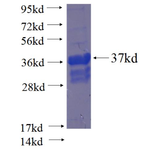 Recombinant human FAM53B SDS-PAGE