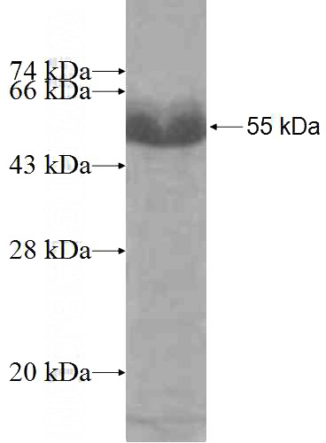 Recombinant Human SUPT5H SDS-PAGE