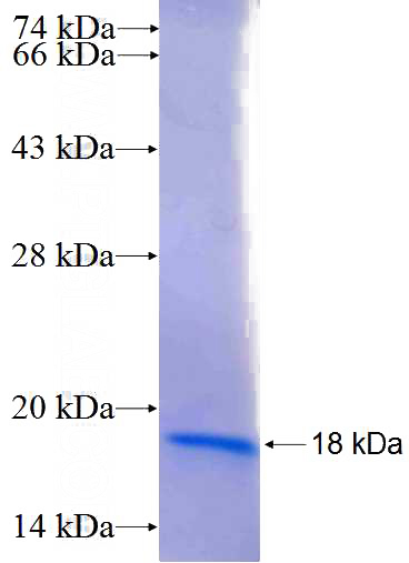 Recombinant Human EPB41L4A SDS-PAGE