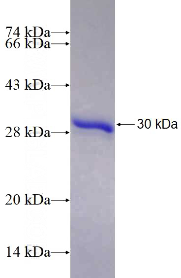 Recombinant Human C9orf72 SDS-PAGE