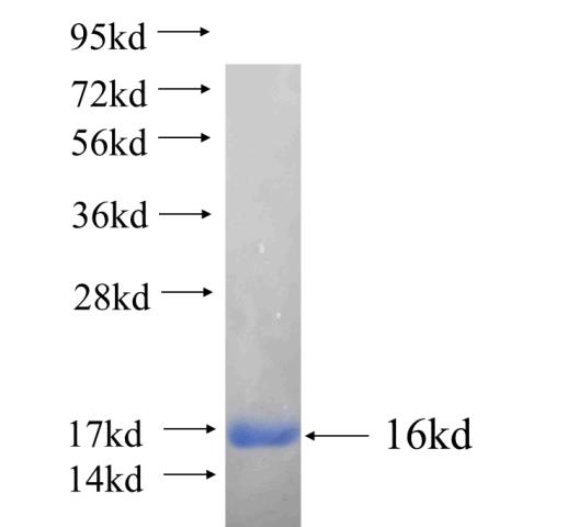 Recombinant human SLC29A4 SDS-PAGE