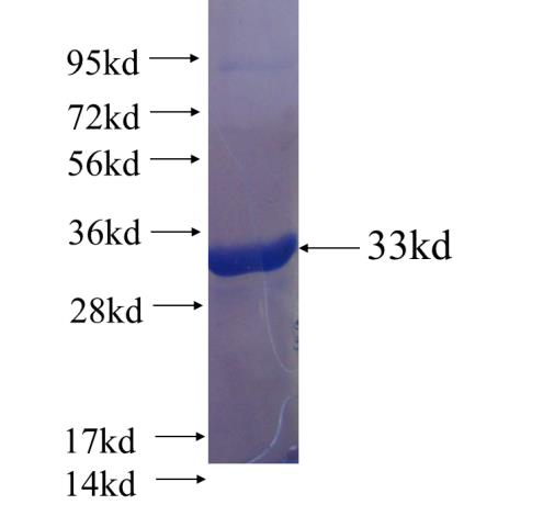 Recombinant human SNX32 SDS-PAGE